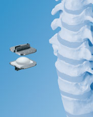 augusta georgia spine center prodisc c