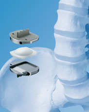 augusta georgia spine center prodisc l