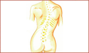 Scoliosis